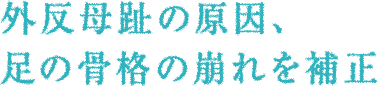 外反母趾の原因、足の骨格の崩れを補正