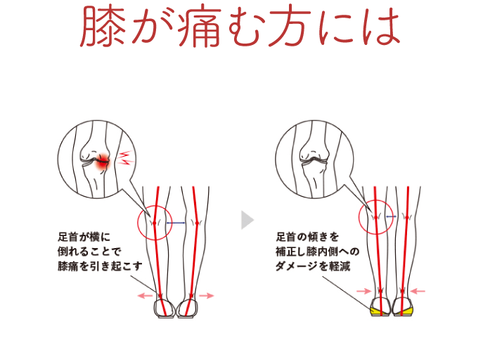 膝が痛む方には
