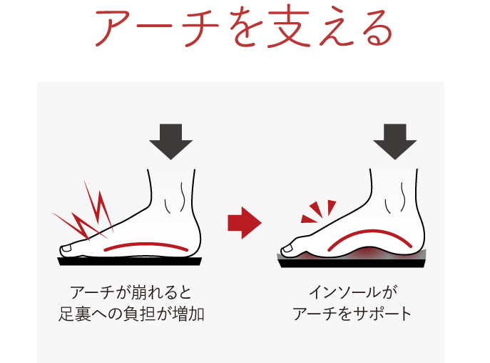 アーチを支える