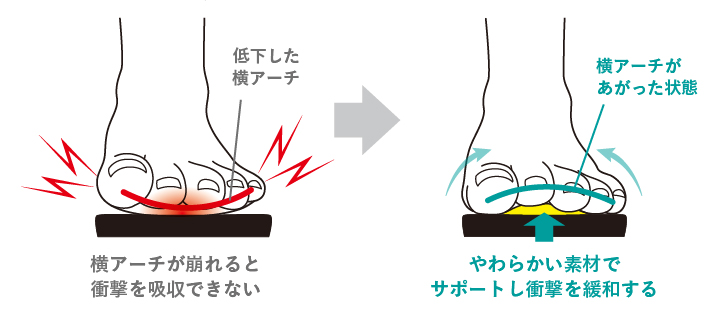 やわらかい素材でサポートし衝撃を緩和する