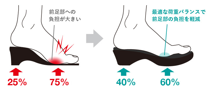 最適な荷重バランスで前足部の負担を軽減