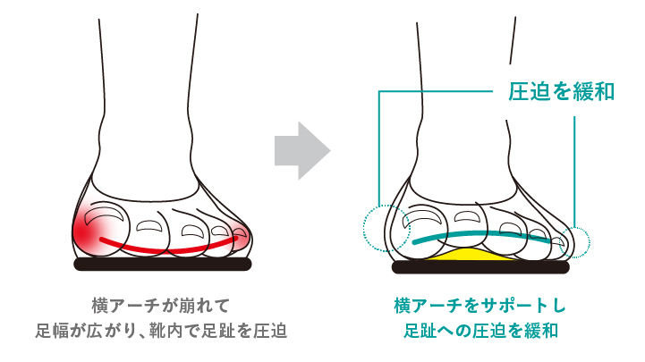 横アーチをサポートし足趾への圧迫を緩和