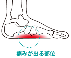 痛みが出る部位