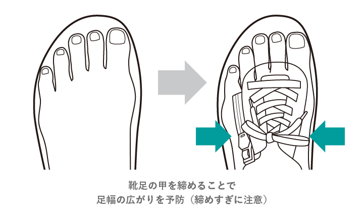 靴足の甲を締めることで足幅の広がりを予防(締めすぎに注意)