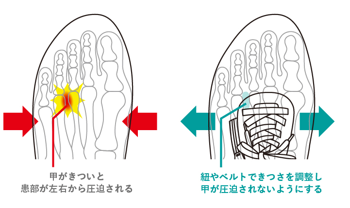 紐やベルトできつさを調整し甲が圧迫されないようにする