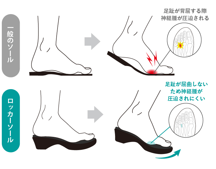 足趾が屈曲しないため神経腫が圧迫されにくい