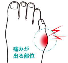 痛みが出る部位