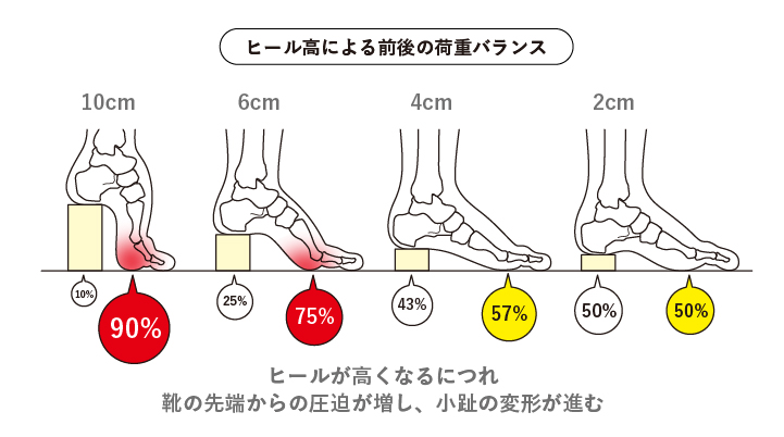ヒールが高くなるにつれ靴の先端からの圧迫が増し、小趾の変形が進む