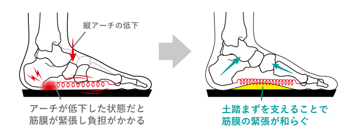 筋膜の緊張が和らぐ