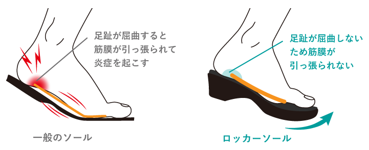 足趾が屈曲しないため筋膜が引っ張られない