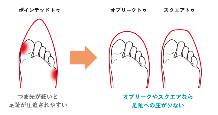 オブリークやスクエアなら足趾への圧が少ない